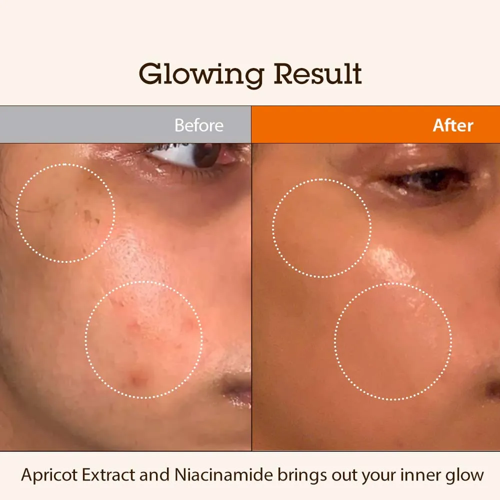 Niacinamide 5.0