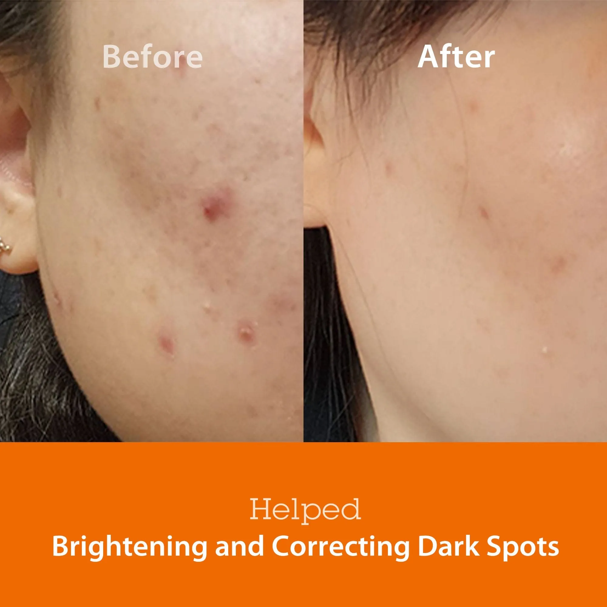 Niacinamide 5.0